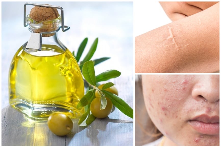 Cây nến là cây gì, tác dụng của nó ra sao và quả của nó có ăn được không?